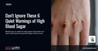 Don’t Ignore These 6 Quiet Warnings of High Blood Sugar