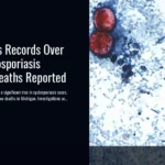 United States Records Over 10,000 Cyclosporiasis Cases, Two Deaths Reported